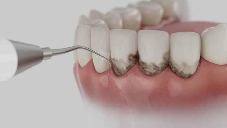 Trusted Root Canal Treatment service in White Castle, LA - Dentist Open Now